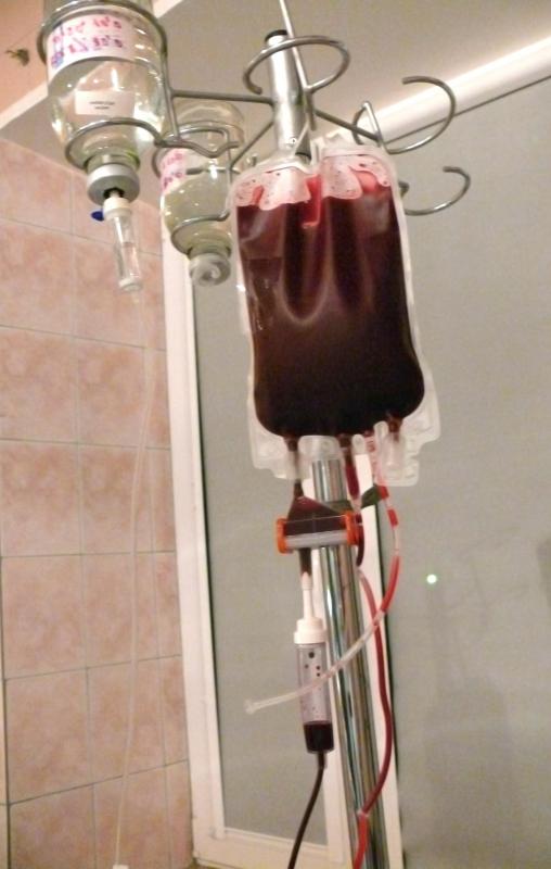 Microwave radiation is never used to warm blood for transfusions.