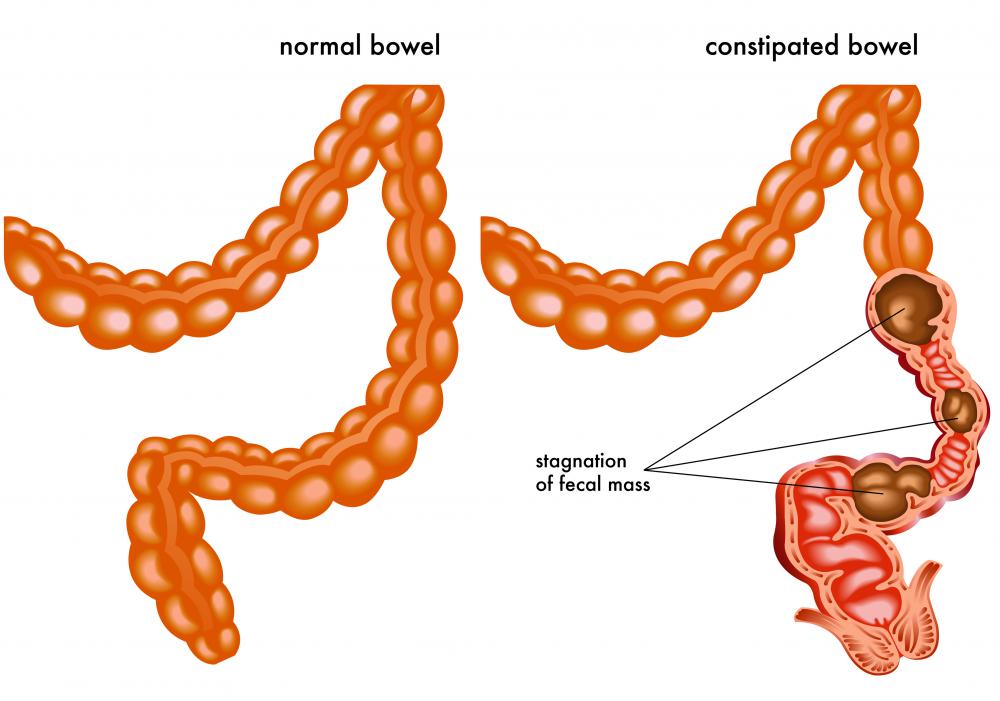 Prunes may be eaten to help relieve constipation.