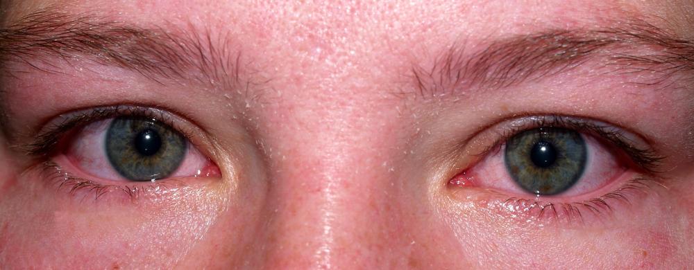 Even the outsides of habaneros can irritate a person's eyes.