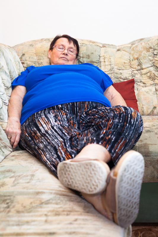 Obesity is a public health problem in many wealthy, industrialized countries.
