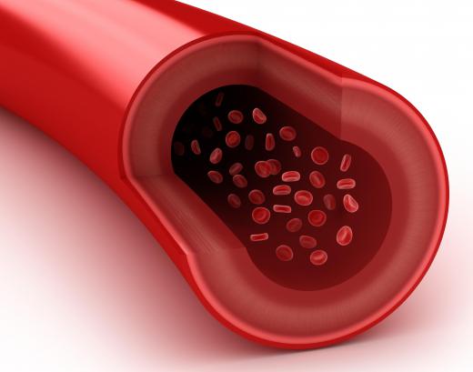 Too much sodium in a diet can lead to high blood pressure.