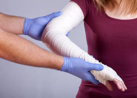 Papain may be used in hospitals to encourage healing in burn patients.