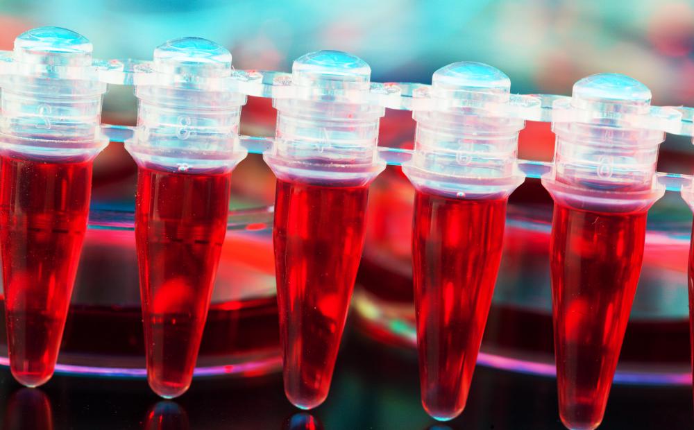 A simple blood test can check for celiac disease.