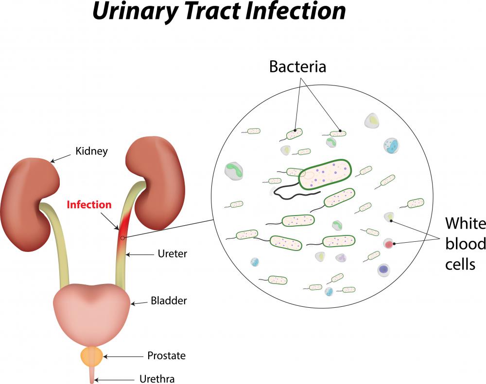 One of the best known benefits of drinking cranberry juice is the prevention of urinary tract infections.