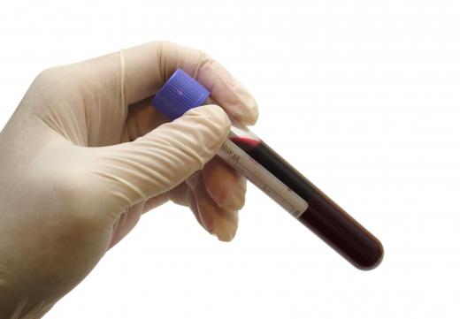 Veterinarians may use refractometers to find the concentration of protein in blood samples.