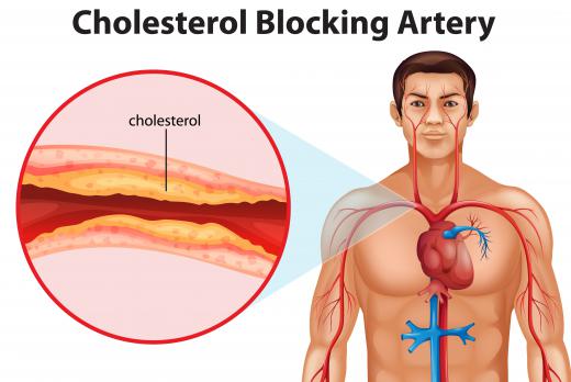 Trans fats have negative effects on the body's healthy HDL cholesterol levels while increasing the level of unhealthy LDL cholesterol.